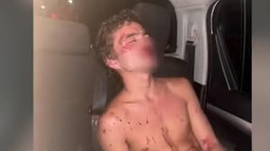 Conductor agredido podría perder visión tras golpiza