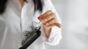 Caída del cabello posparto: causas y soluciones efectivas