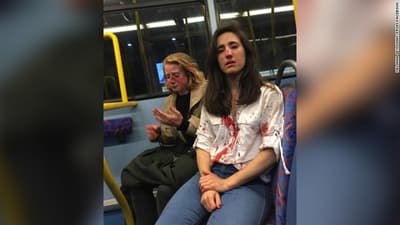 Muelen a golpes a pareja de lesbianas