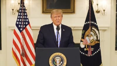 Trump sufre de insuficiencia venosa crónica