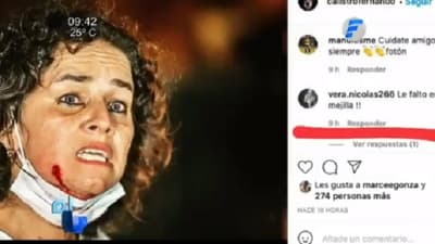Policía lanza despreciable mensaje hacia ciudadana herida  