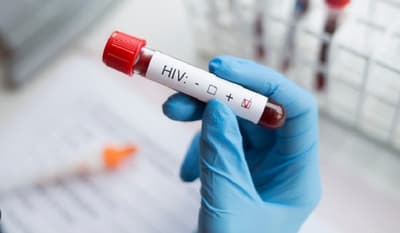 Adolescente muere el mismo día que le dan su diagnóstico de VIH