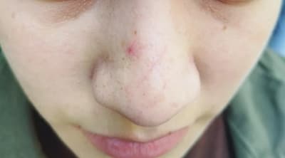 Embarazada denuncia agresión y despido de una chipería