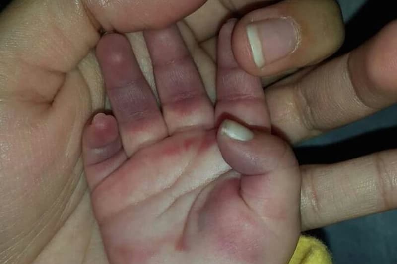 Denuncian maltrato y negligencia en Hospital San Pablo