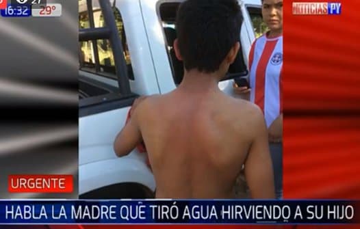 Mujer “baña” a su hijo con agua caliente