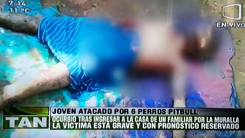 Hombre atacado por perros pitbull está grave