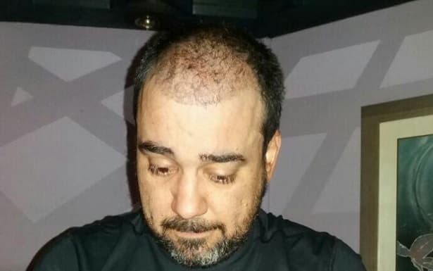 Entraron a un motel y solo el hombre salió con vida