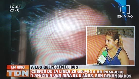 Niña sufre fuerte golpe debido a pelea en bus