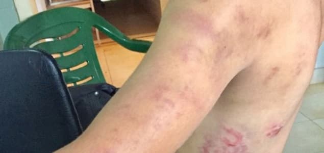 Niño sufre graves maltratos