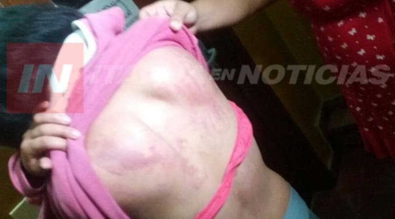 Torturó con cinto y destornillador a su expareja