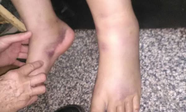 Recibía una golpiza por cada “Me gusta” en Facebook