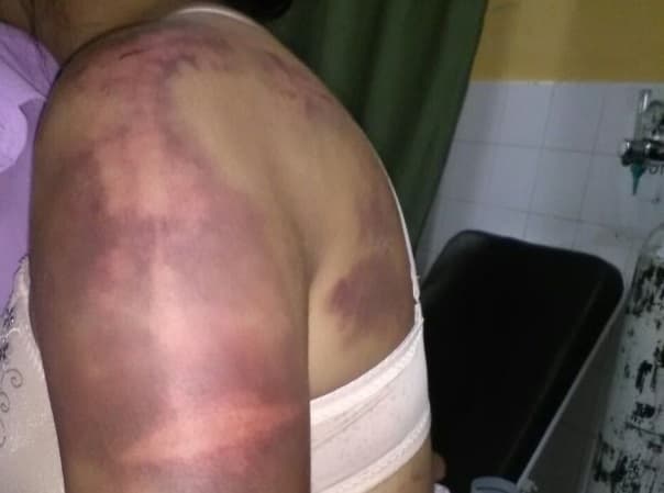 Mujer sufre fuerte golpiza