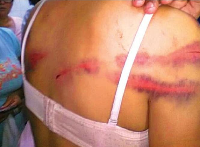 Hombre que golpeó brutalmente a su pareja irá a Emboscada