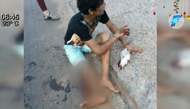 Supuesto motochorro pierde una pierna luego de atraco