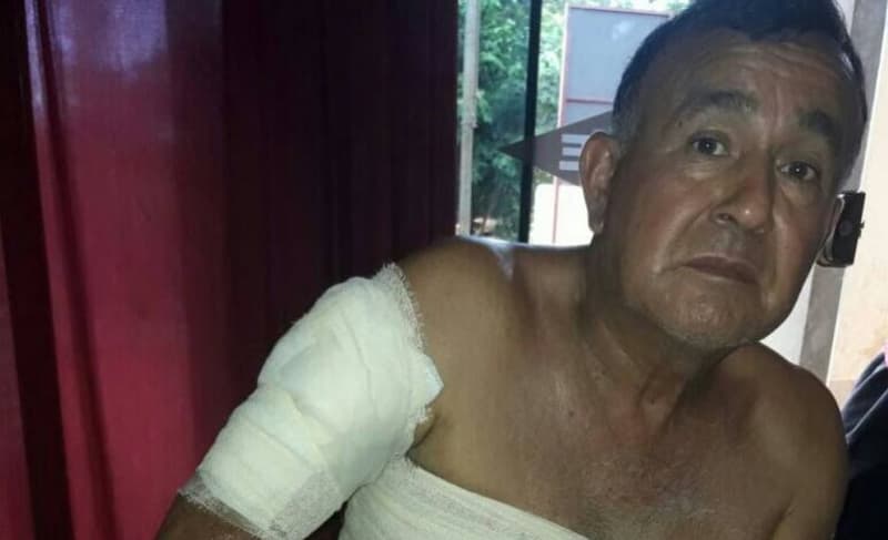 Mujer "bañó" con aceite caliente a su expareja y huyó