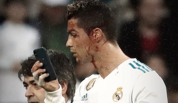 Cristiano, ensangrentado, pidió un teléfono para inspeccionar su rostro