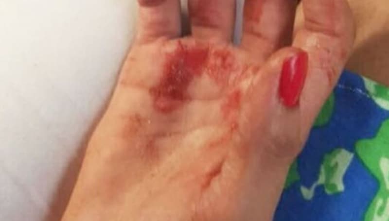 Joven denuncia que fue golpeada por su padre y su novio