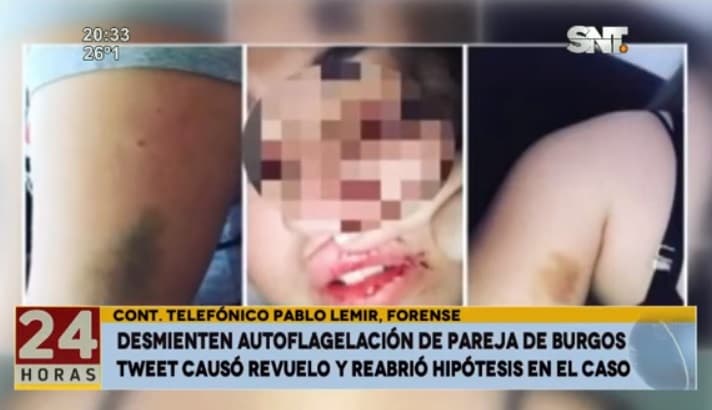 Forense niega autoflagelación de esposa de Rodrigo Burgos