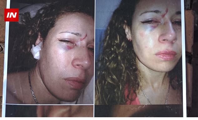 Harta de desidia, mujer denuncia a sobrino de ministra por violencia familiar