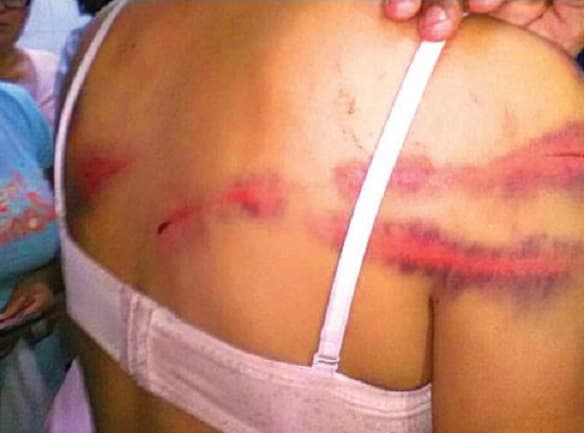 Madre de acusado por violencia paga a víctima para disminuir posible condena