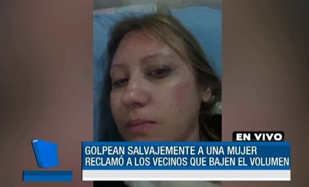 Docente universitaria fue golpeada por reclamar elevado volumen de música