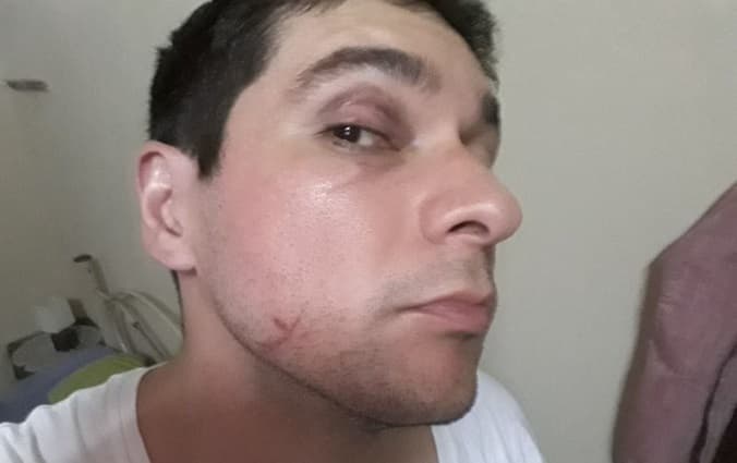 Denuncian llamativa celeridad en caso de acusación mutua por violencia familiar