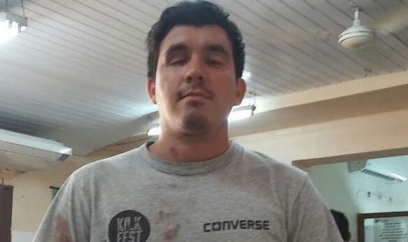 Joven que perdió un ojo responde a Cartes: “Me da un poco de rabia y pena por él”