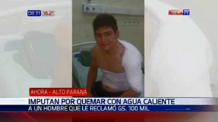 Imputan al hombre que causó graves quemaduras con agua caliente a joven