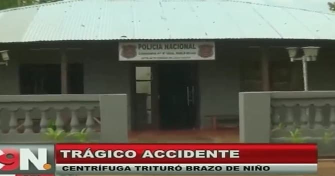 Niño pierde un brazo en accidente casero