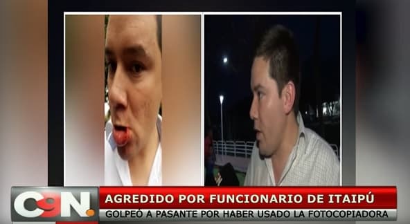 Pasante de Itaipú fue golpeado en disputa por fotocopiadora, denuncia