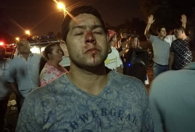 Agreden a manifestante en J. Augusto Saldívar