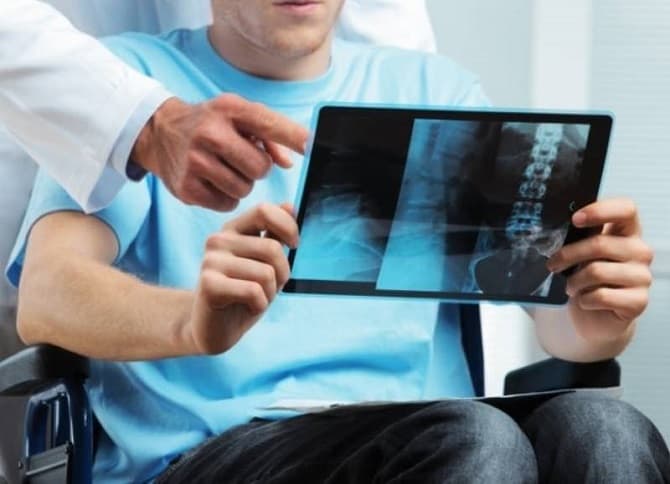 La esclerosis es la enfermedad más discapacitante que afecta a población productiva