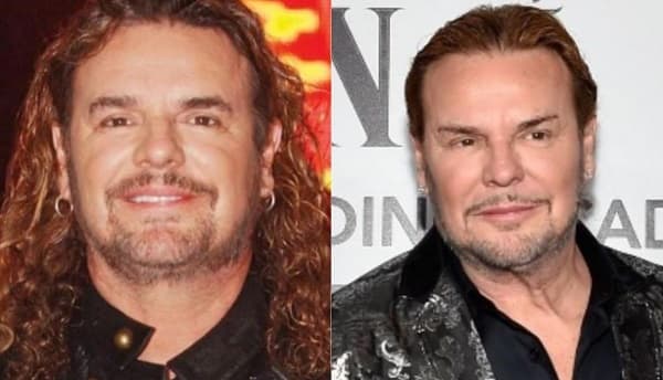 Operación en el rostro casi mata a líder de Maná