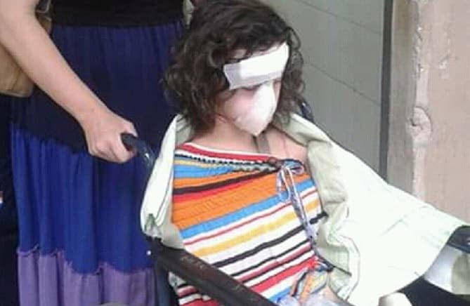 Madre pide ayuda para tratamiento de su hija tras accidente