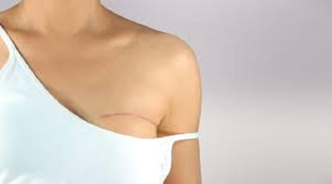 Rejuvenecer o reconstruir la piel es posible mediante técnica, según especialista