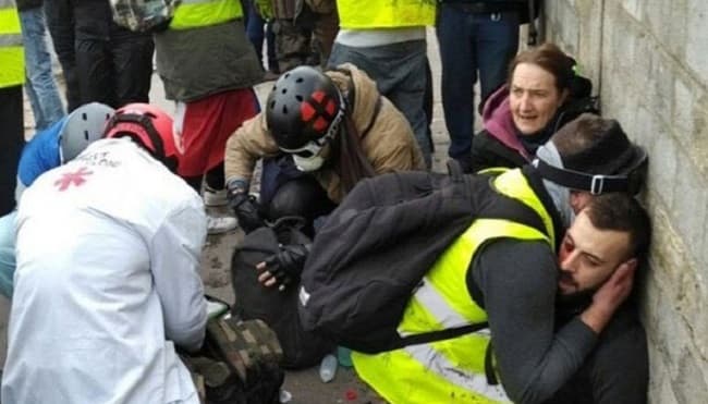Manifestante pierde una mano en reyerta con policías
