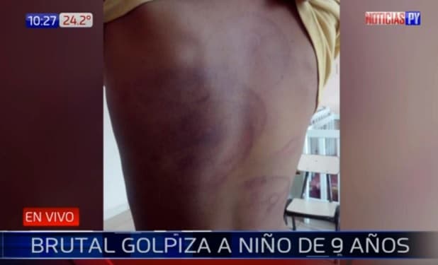 Denuncian golpiza sufrida por niño