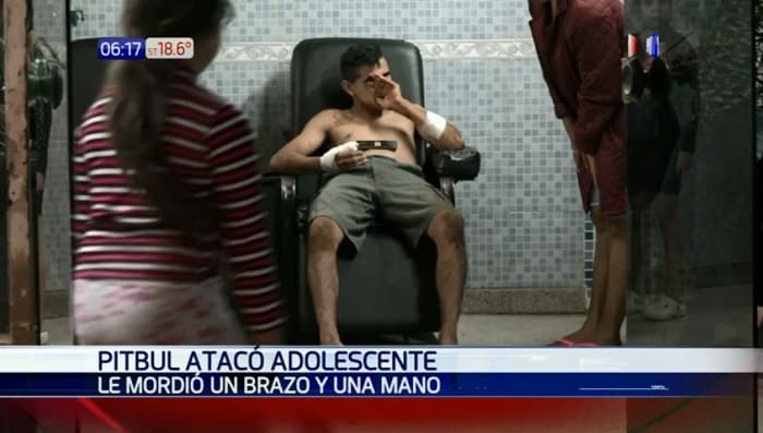 Joven sufre heridas tras ataque de pitbull