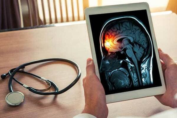 La meningitis: Una enfermedad grave y contagiosa explicada en 10 datos