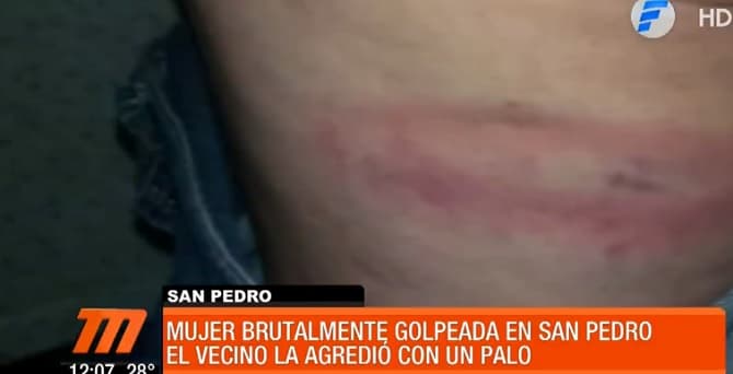 Mujer denuncia a su vecino por golpiza