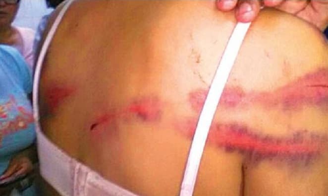 Joven es condenado a 20 años de cárcel por golpear a su pareja