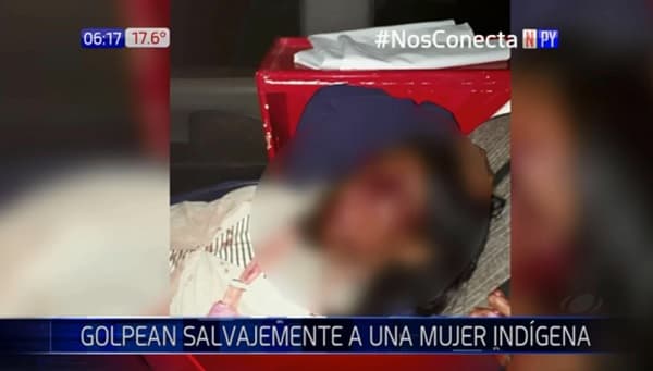 Nativa es desfigurada a golpes por su pareja