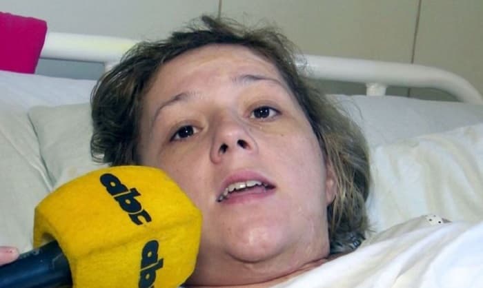 Fiscala habla de nuevos indicios en caso de mujer baleada por policía