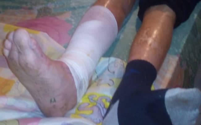 Denuncian mala atención y desidia en Hospital de Lambaré