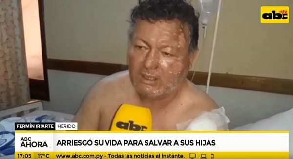 Padre salva la vida de sus hijas durante incendio en Caaguazú