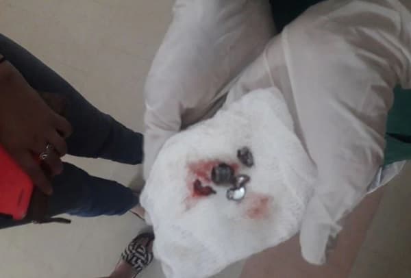 Policía resulta herido durante cateo en Lambaré