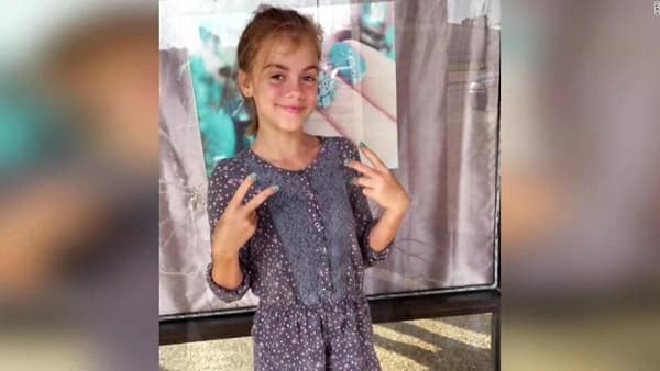 Muere niña que contrajo una ameba come cerebros