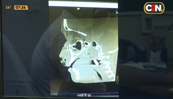 Joven baleada en el rostro tendrá que someterse a reconstrucción facial