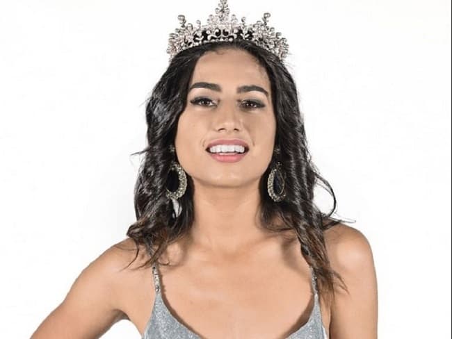 Prueba de dengue en exmiss luqueña dio negativo, según Salud