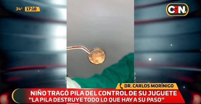 Niño está en terapia intensiva luego de tragar una pila
